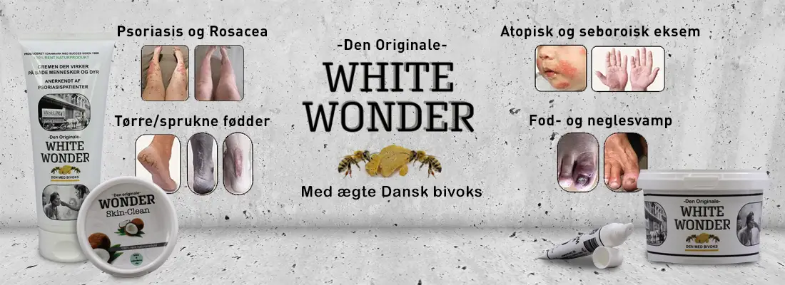 White Wonder Banner med produkter og før/efter billeder.